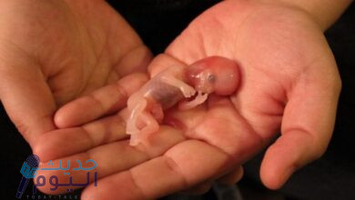 إجهاض الجنين