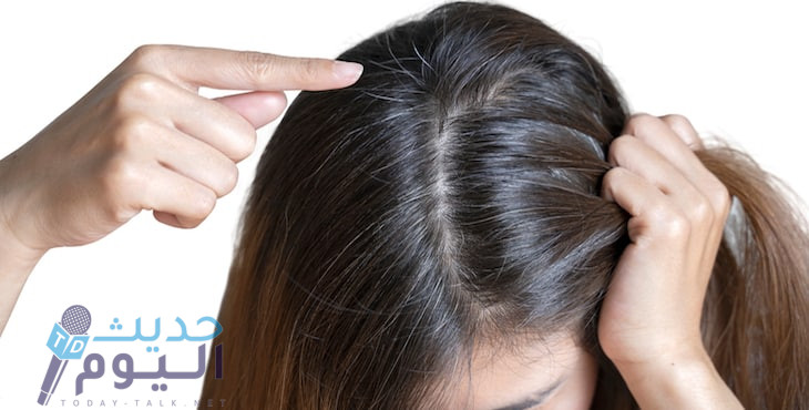 أسباب نقص الميلانين في الشعر وطرق العلاج