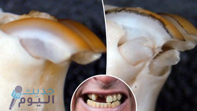 دواء المعجزة يسمح بإعادة نمو الأسنان بعد سقوطها .. تعرف عليه